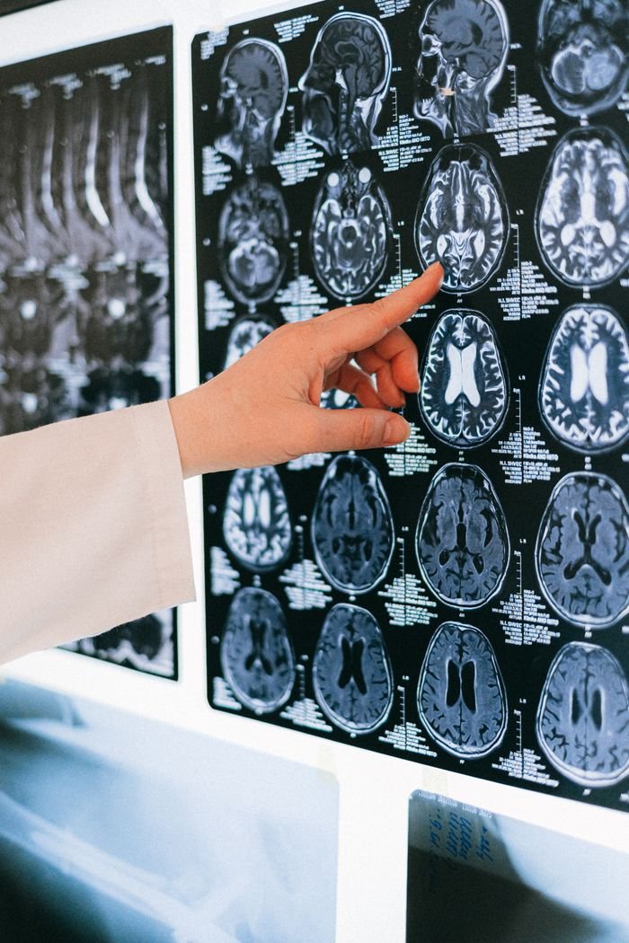 about-us-01 A doctor's hand points to a brain MRI scan on a lightbox, illustrating medical diagnosis.