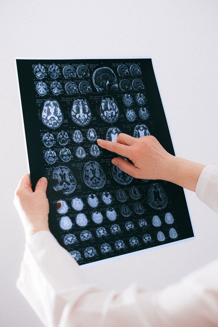 about-us-02 A medical professional examines a brain MRI scan, focusing on neurological health.