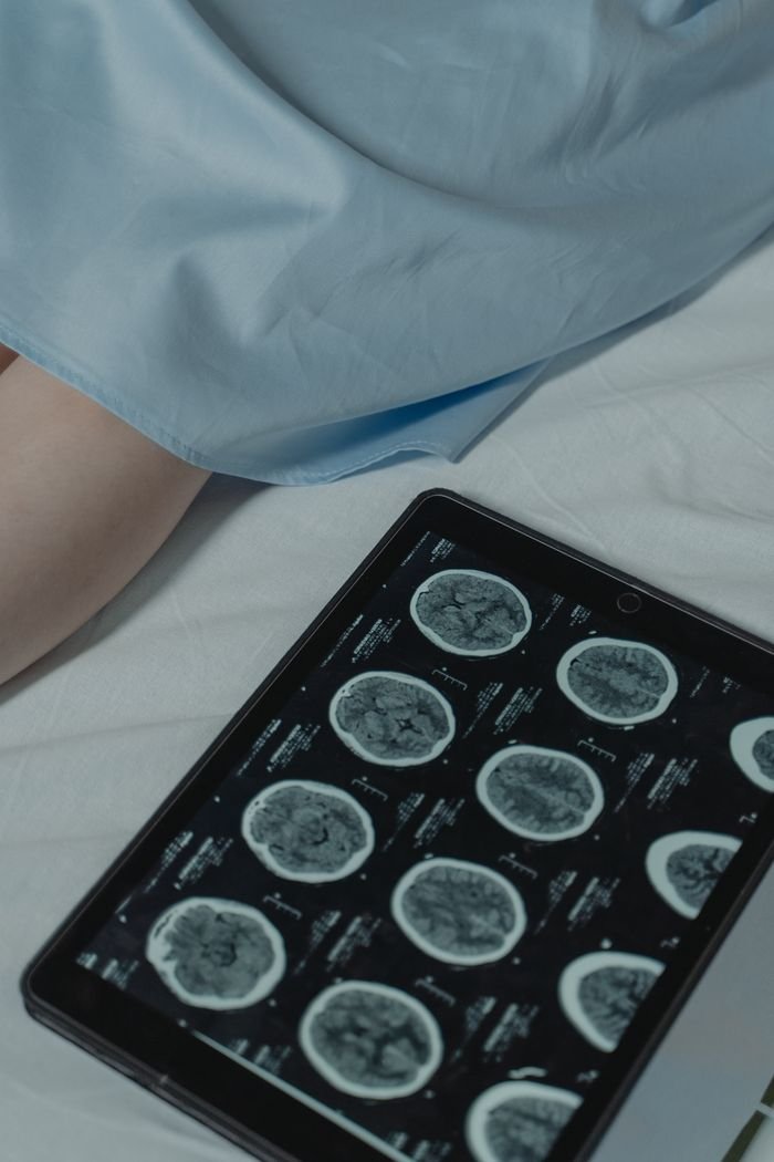 services-04 Close-up of a digital tablet showing brain scans next to patient in a hospital setting.