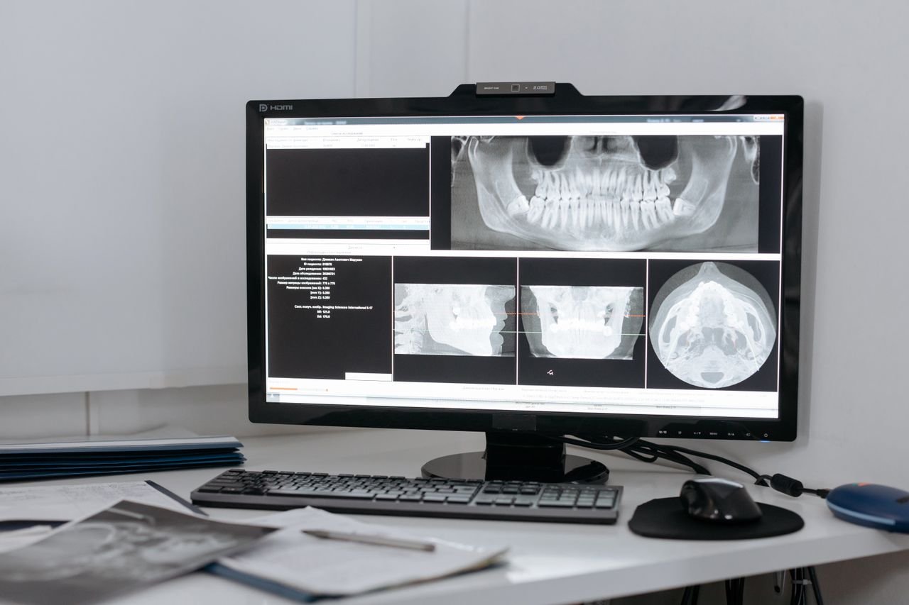 about-us-02 Monitor displaying dental X-ray images in a clinic setup for diagnostic purposes.
