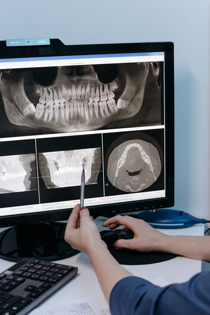 Crafting Captivating Headlines: Your awesome post title goes here Close-up of a dental professional analyzing X-ray scans on a computer monitor.